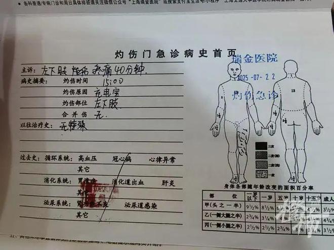 男子裤袋里的充电宝突然起火大腿三级烧伤！“非召回批次买来不到一年”！(图2)