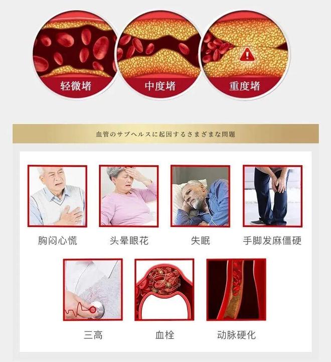 日本黑科技纳豆激酶PLUS+给血管做“大扫除”！(图5)